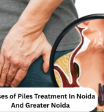 Causes of piles showing common risk factors including constipation, pregnancy, obesity, prolonged sitting, and low-fiber diet.