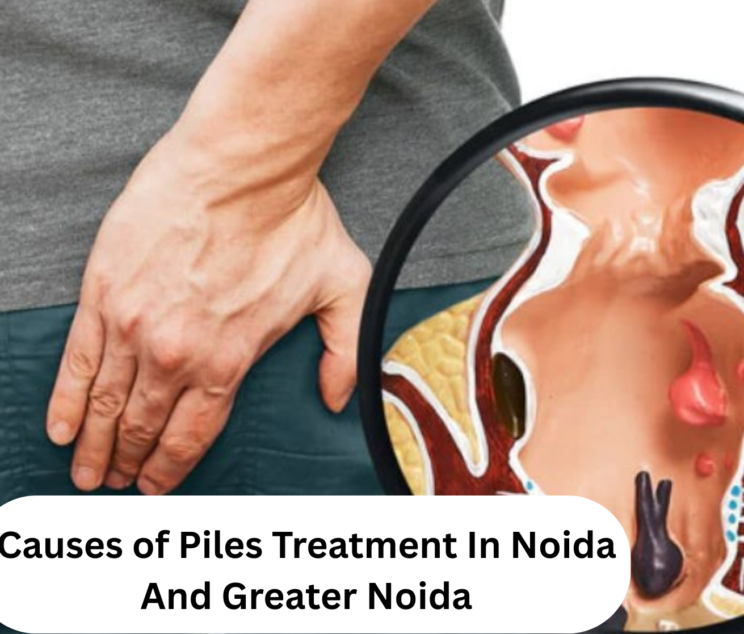 Causes of piles showing common risk factors including constipation, pregnancy, obesity, prolonged sitting, and low-fiber diet.