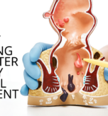 Anal fissure treatment in Noida