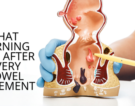 Anal fissure treatment in Noida