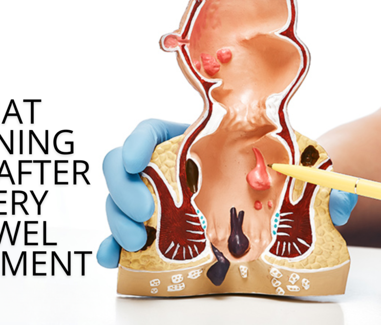 Anal fissure treatment in Noida