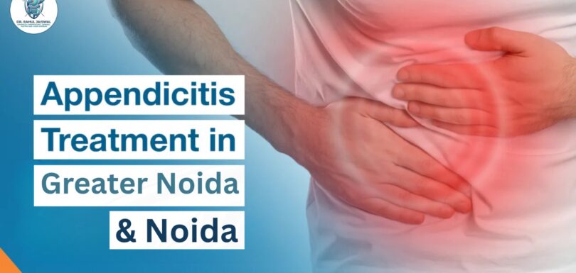 Appendicitis Treatment in Noida & Greater Noida