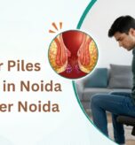 Laser piles surgery in Noida and Greater Noida