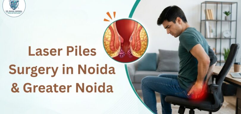 Laser piles surgery in Noida and Greater Noida
